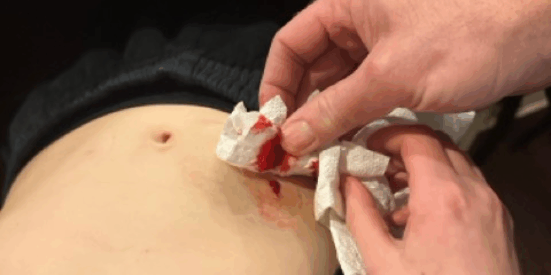 One Tough Site Change, One Brave Kid